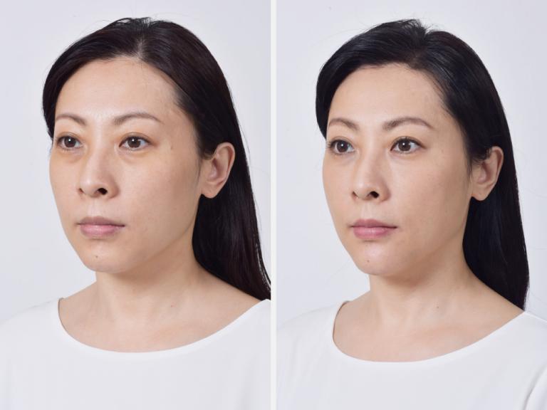 案例 C 小姐