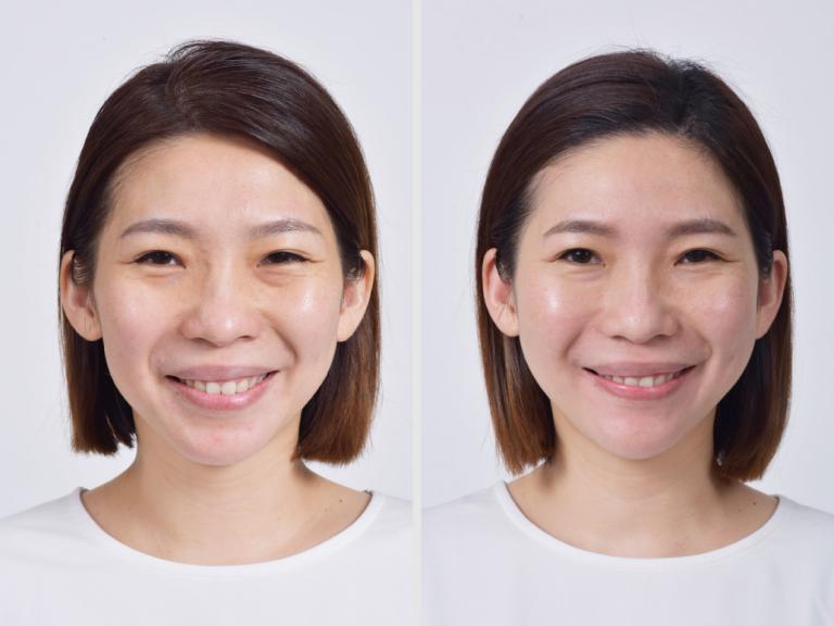 案例 D 小姐